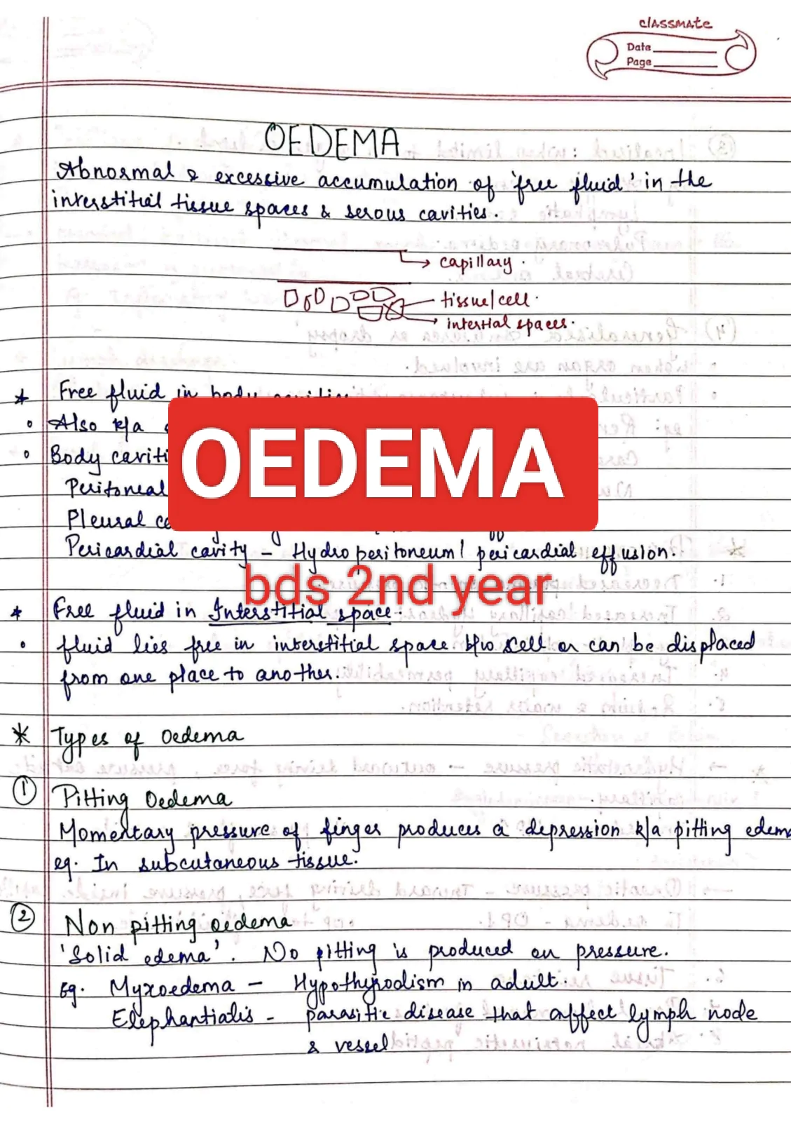 Oedema PATHOLOGY BDS 2nd year handwritten notes for University exams PDF