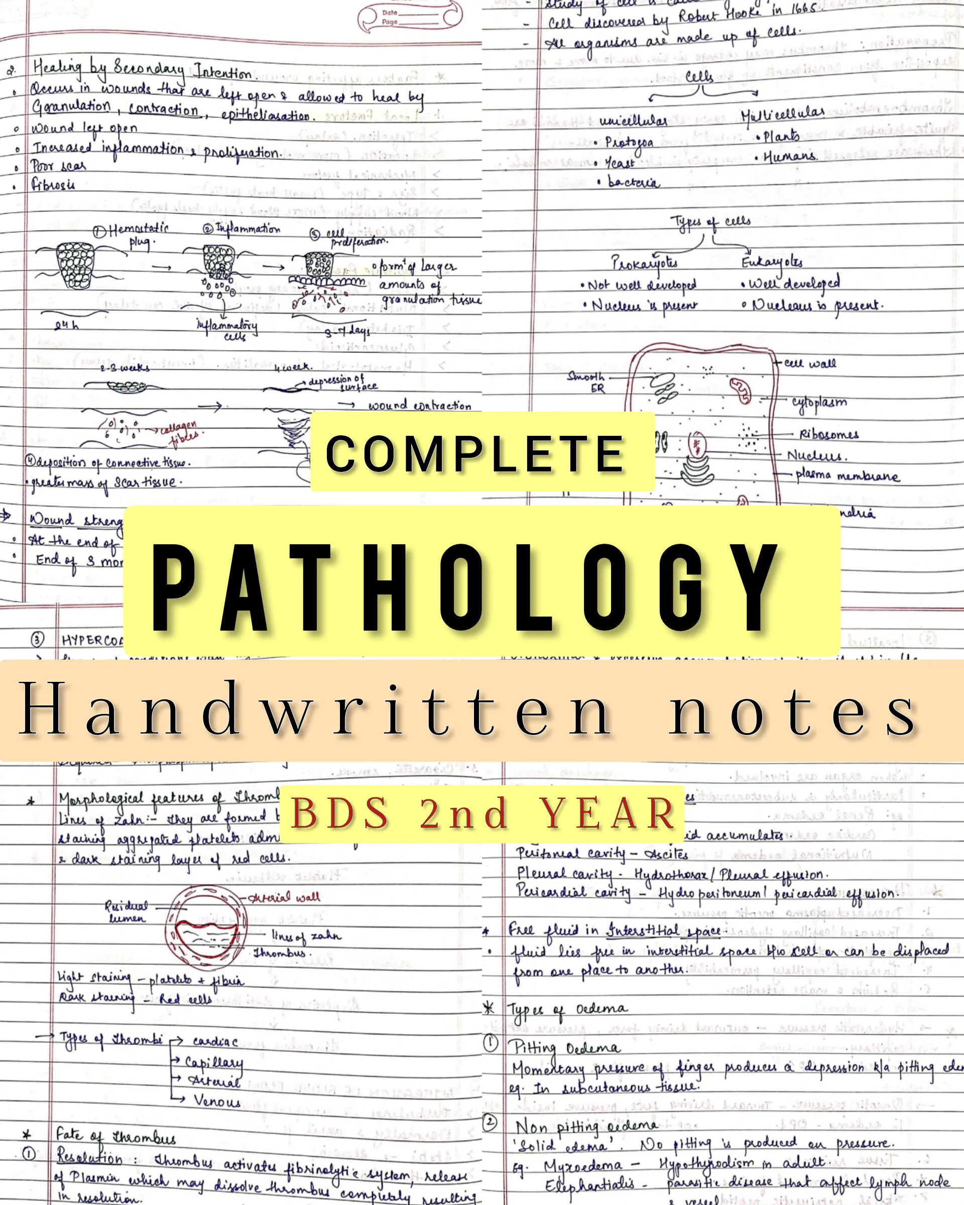 BDS 2nd year ALL SUBJECTS handwritten notes of PATHOLOGY, MICROBIOLOGY, DENTAL MATERIALS and PHARMACOLOGY. Revision notes for University exams 💯 PDF - Image 3