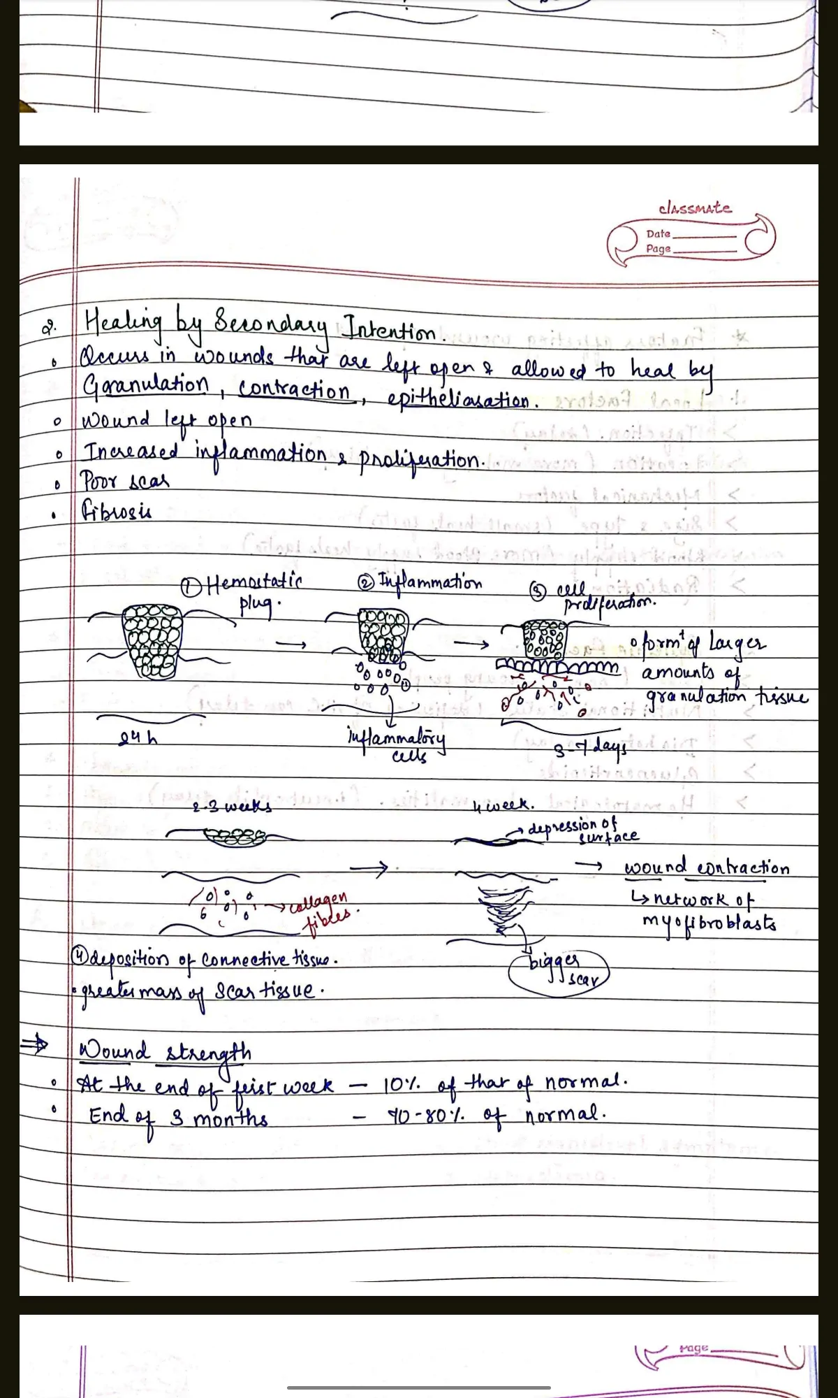 PATHOLOGY COMPLETE handwritten notes for BDS 2nd year University exams PDF - Image 5