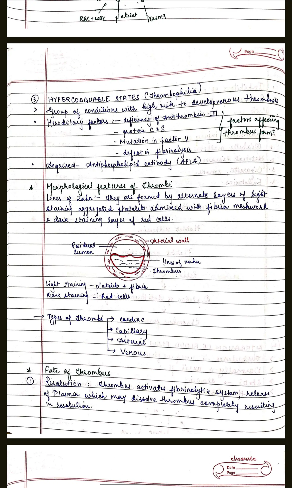 PATHOLOGY COMPLETE handwritten notes for BDS 2nd year University exams PDF - Image 6