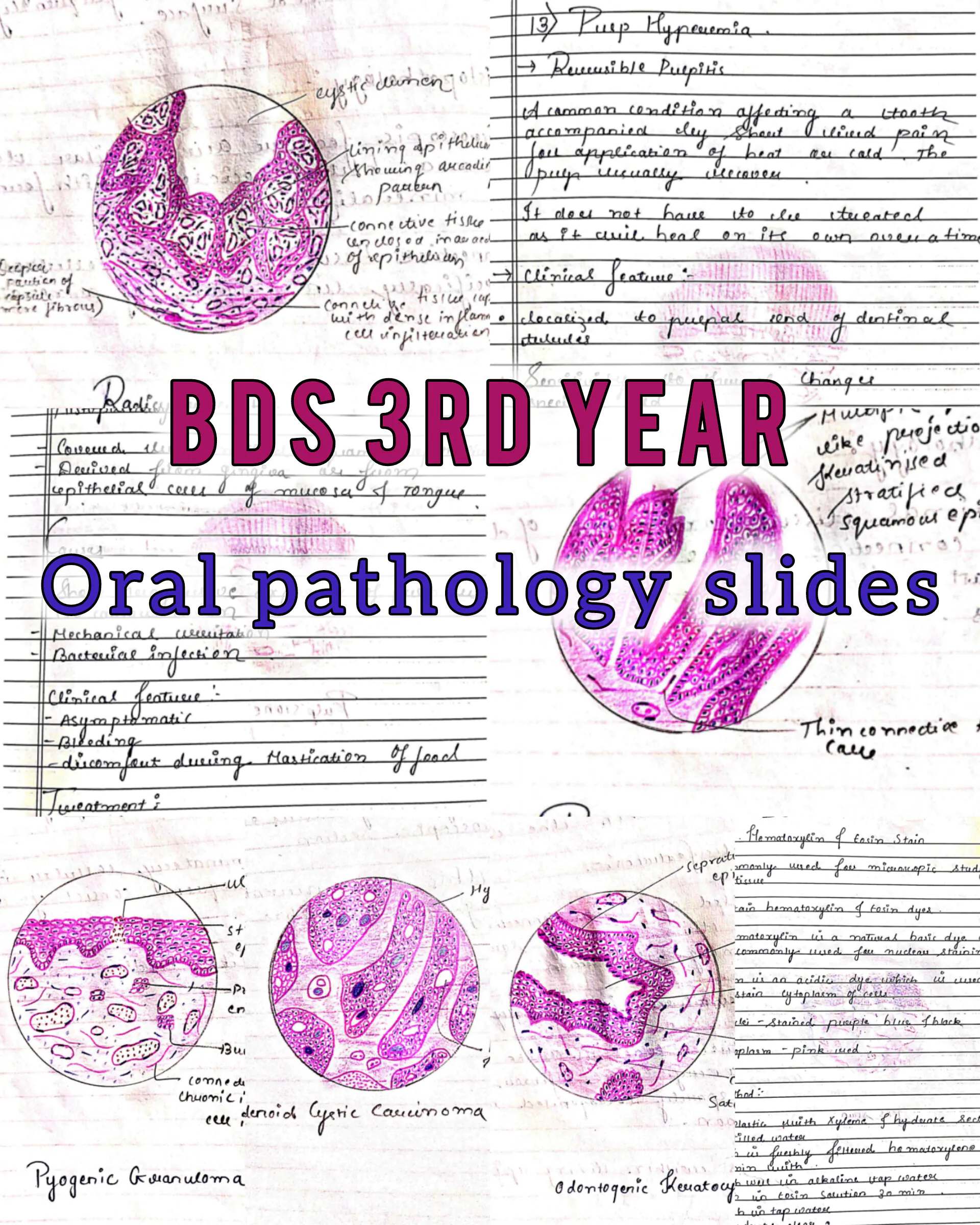 BDS 3rd year ALL SUBJECTS handwritten notes of GENERAL SURGERY, GENERAL MEDICINE and ORAL PATHOLOGY. Revision notes for University exams 💯 PDF - Image 5