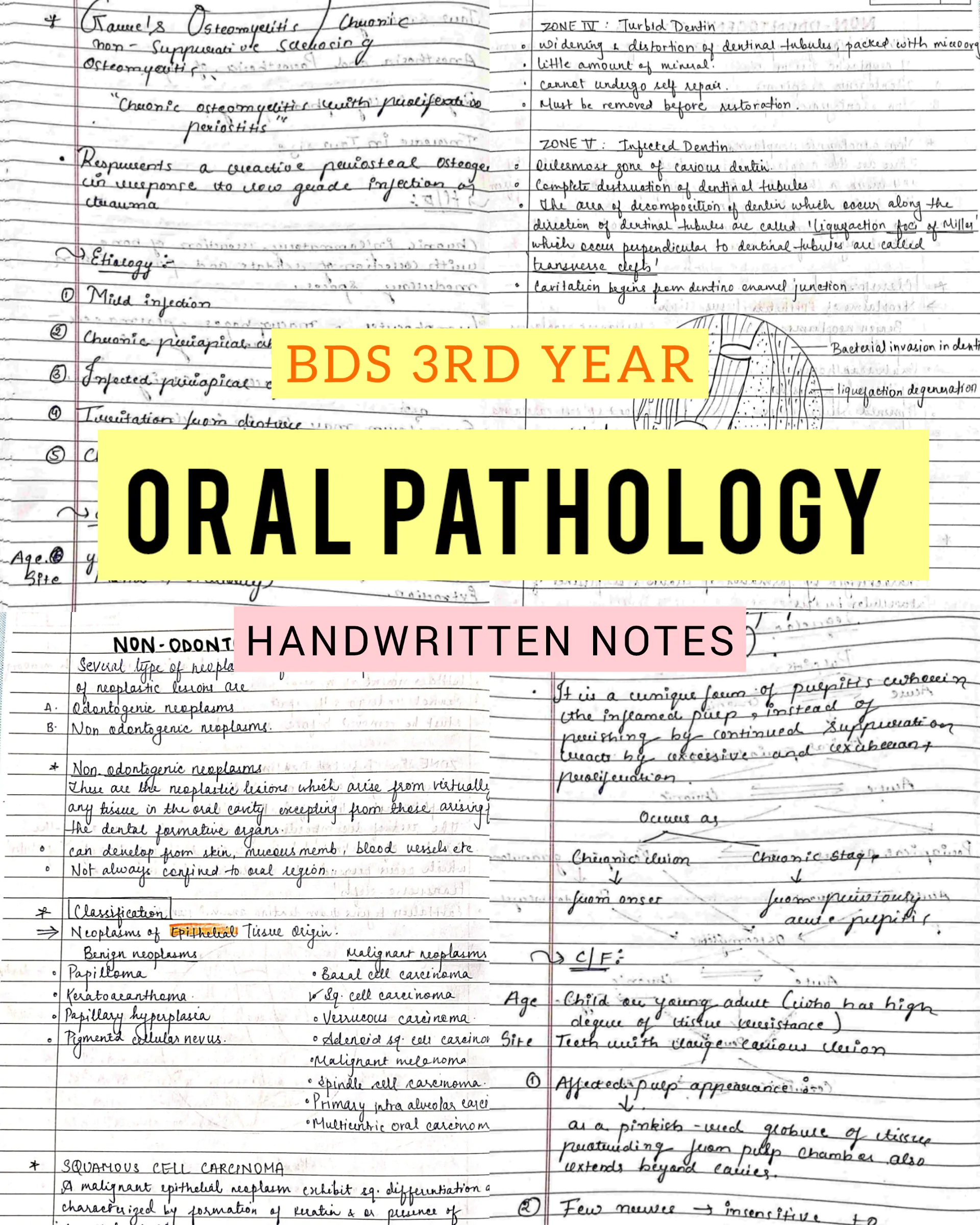 BDS 3rd year ALL SUBJECTS handwritten notes of GENERAL SURGERY, GENERAL MEDICINE and ORAL PATHOLOGY. Revision notes for University exams 💯 PDF - Image 4