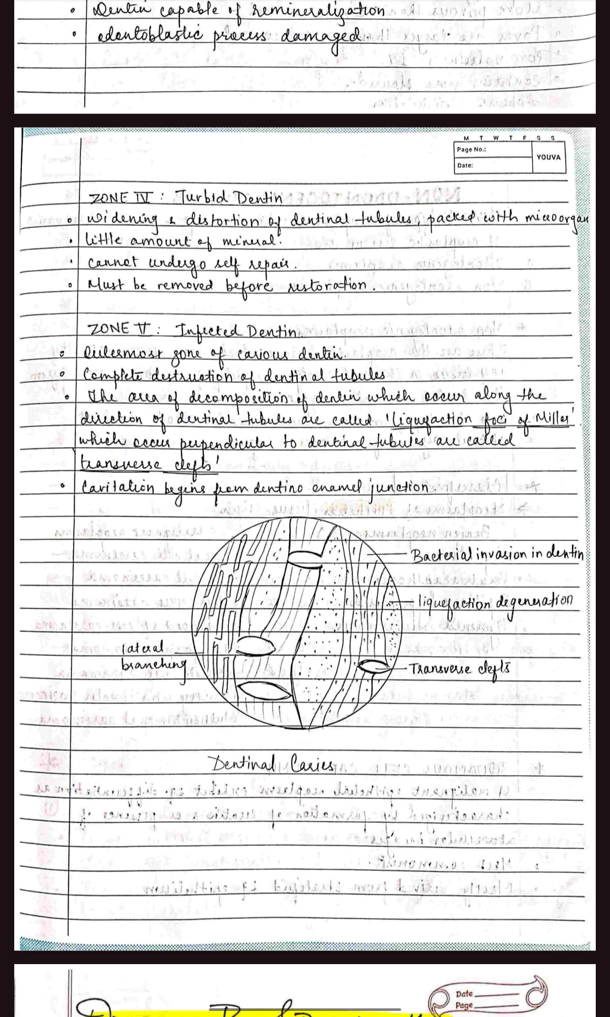 BDS 3rd year ALL SUBJECTS handwritten notes of GENERAL SURGERY, GENERAL MEDICINE and ORAL PATHOLOGY. Revision notes for University exams 💯 PDF - Image 7