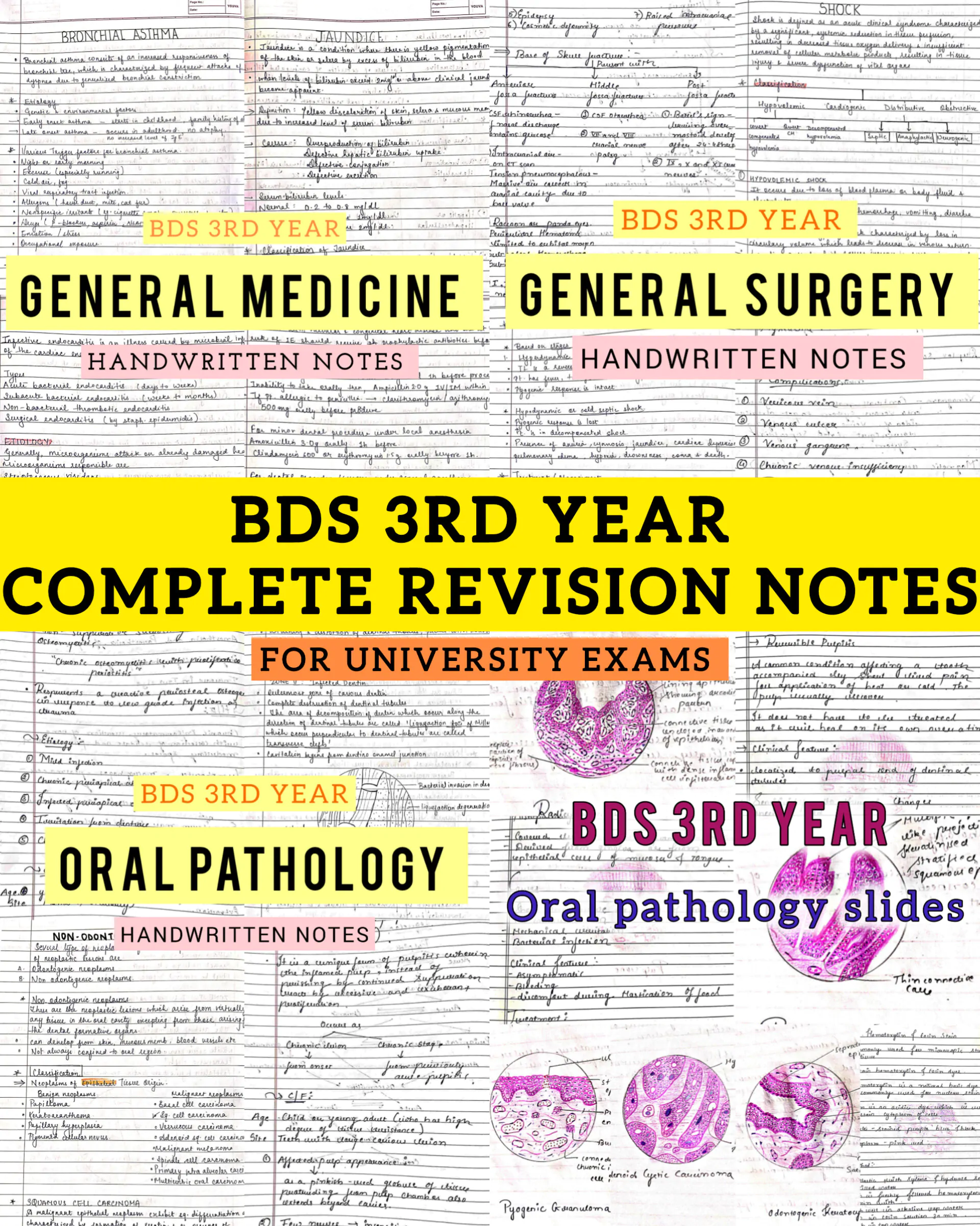 BDS 3rd year ALL SUBJECTS handwritten notes of GENERAL SURGERY, GENERAL MEDICINE and ORAL PATHOLOGY. Revision notes for University exams 💯 PDF