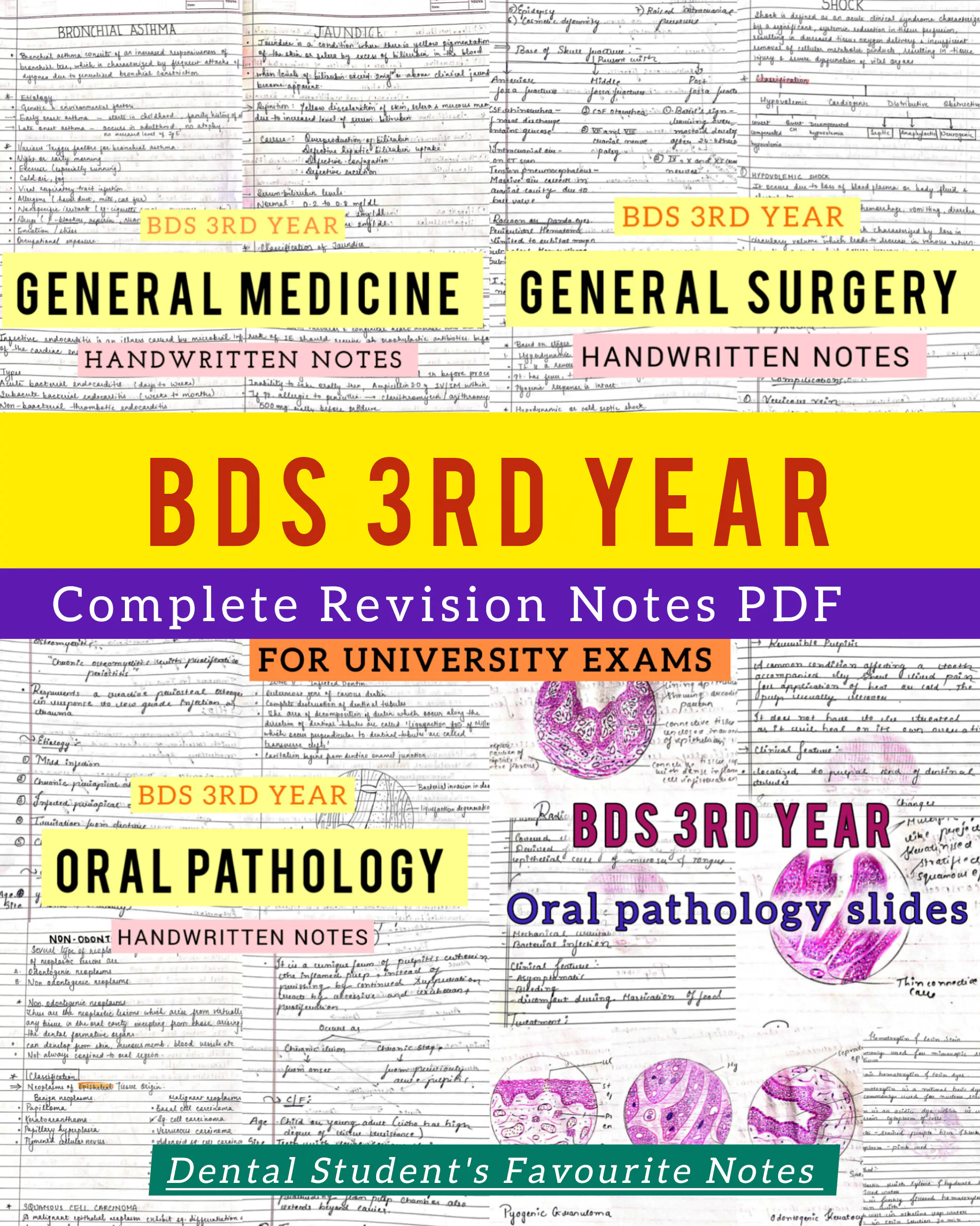 BDS 3rd year ALL SUBJECTS handwritten notes of GENERAL SURGERY, GENERAL MEDICINE and ORAL PATHOLOGY. Revision notes for University exams 💯 PDF
